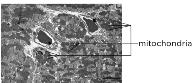A micrograph of muscle tissue in a mouse, showing mitochondria.