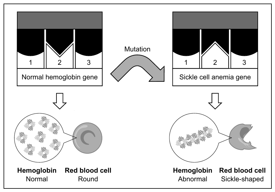The sickle cell mutation