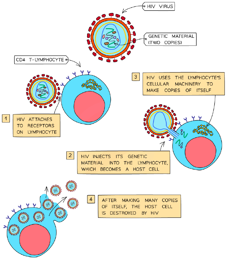 How HIV infects a lymphocyte