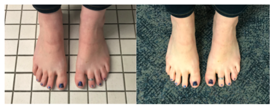 Feet on a tile floor and on carpet